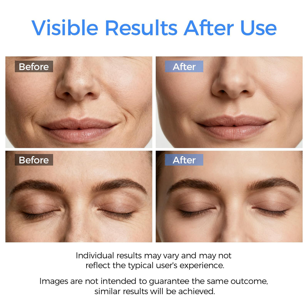 DABZAL nettoyeur-visage mode Ion Plus éliminant les impuretés