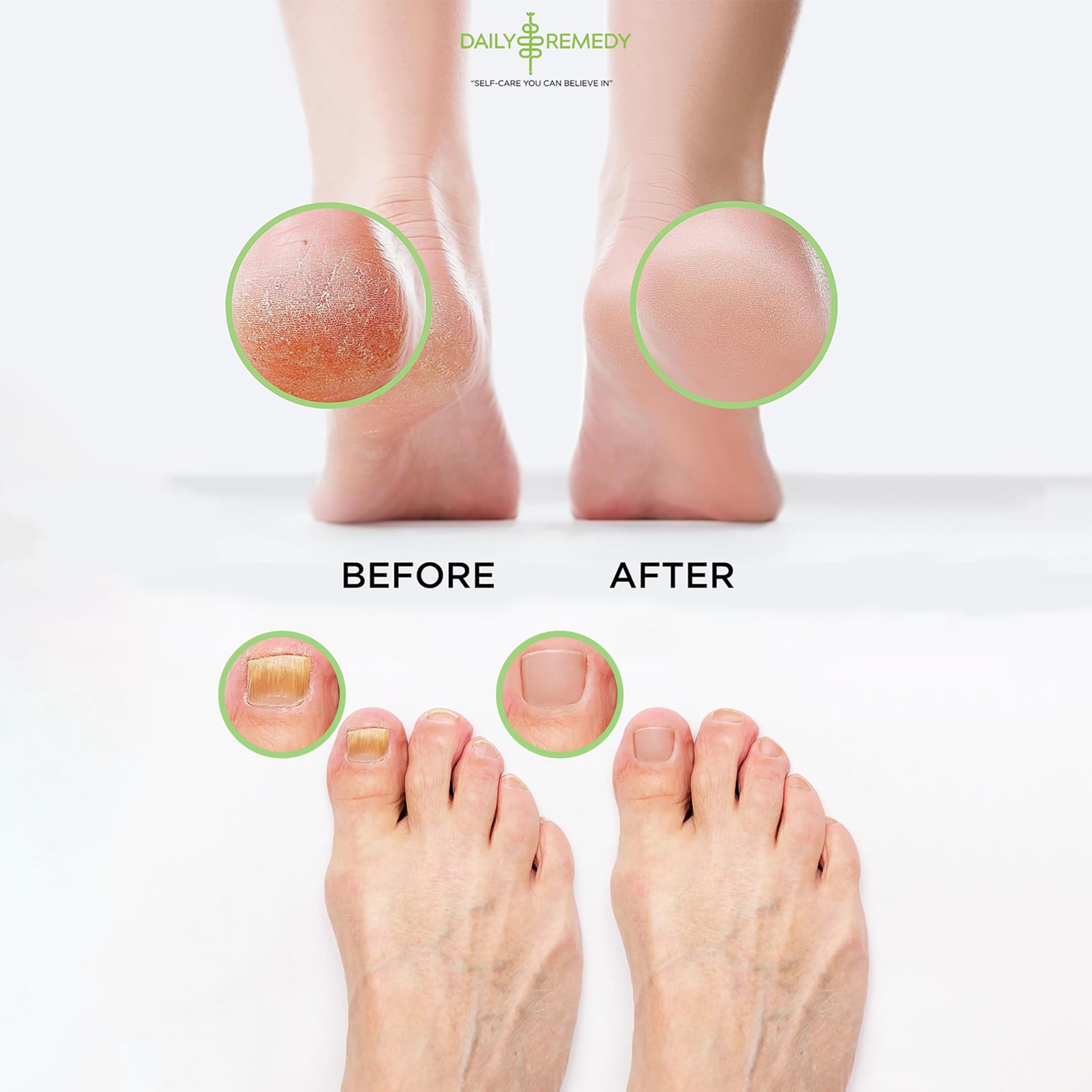 DAILY REMEDY bAIN-pieds sels mer-morte epsom: nourrit et adoucit la peau