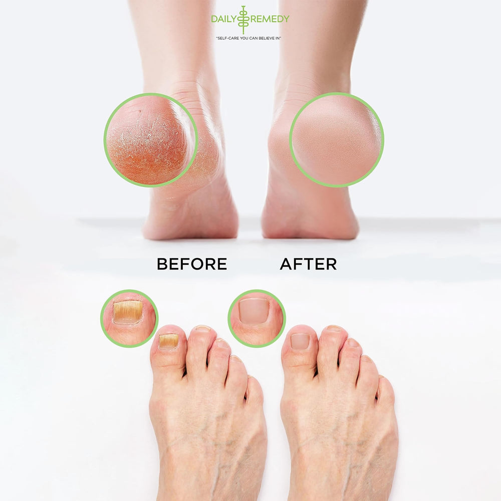 DAILY REMEDY bAIN-pieds sels mer-morte epsom: nourrit et adoucit la peau