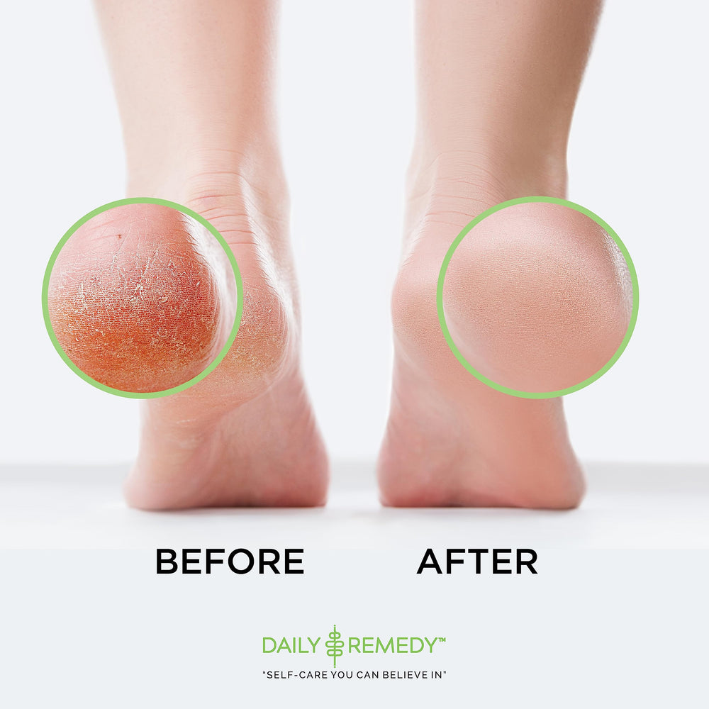 DAILY REMEDY pedicure-quality foot soak for an at-home spa day.