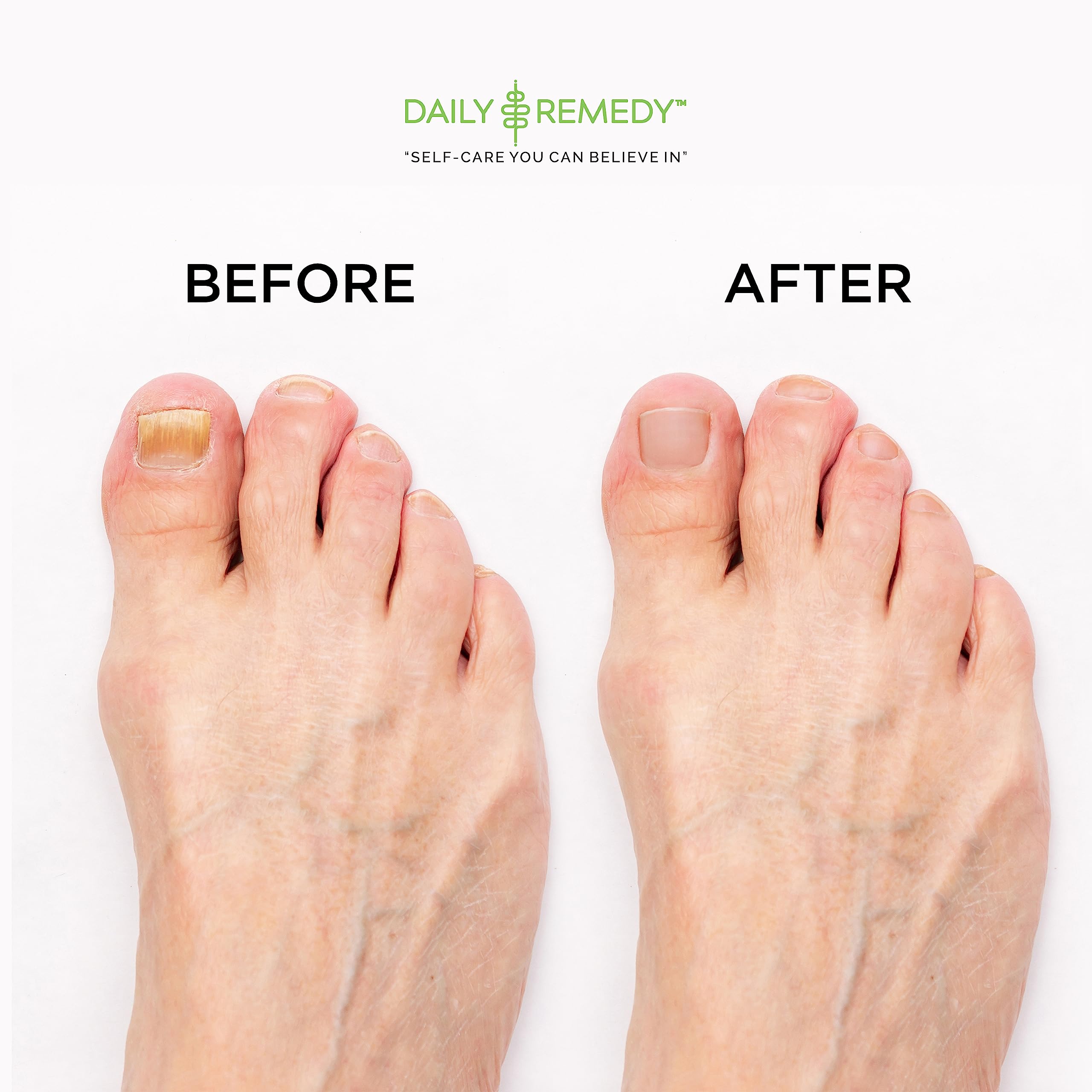 DAILY REMEDY foot soak ingredients highlight tea tree and essential oils.
