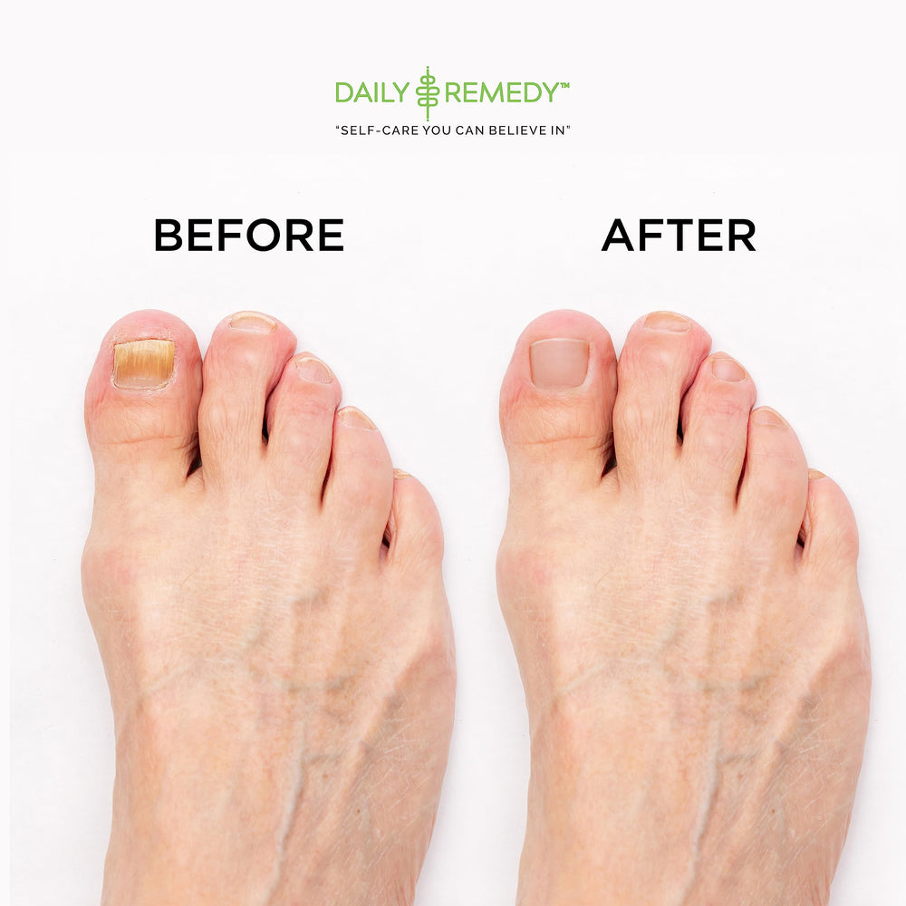 DAILY REMEDY foot soak ingredients highlight tea tree and essential oils.