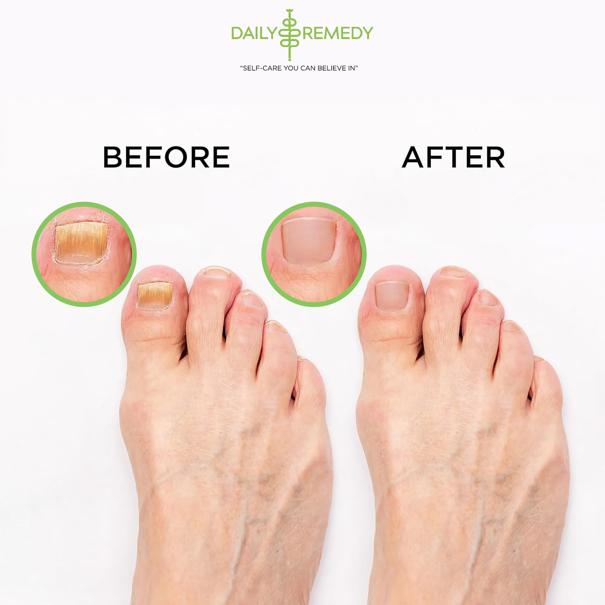 Daily Remedy guide d’utilisation à domicile pour pieds fatigués après sport.