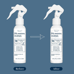 Application Danliss Minoxidil sur le cuir chevelu, routine simple.