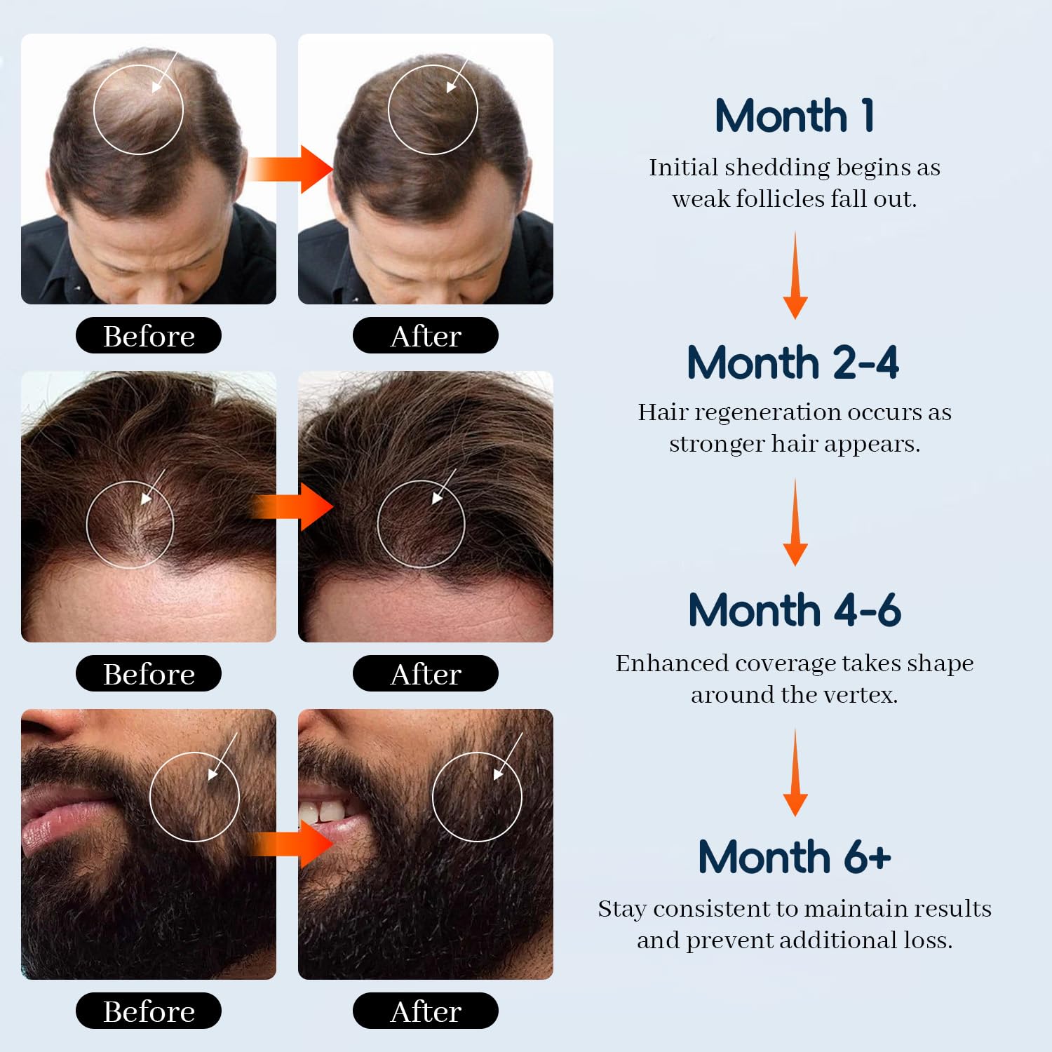 Biotine ajoutée dans Danliss Minoxidil pour nourrir les cheveux et les poils.