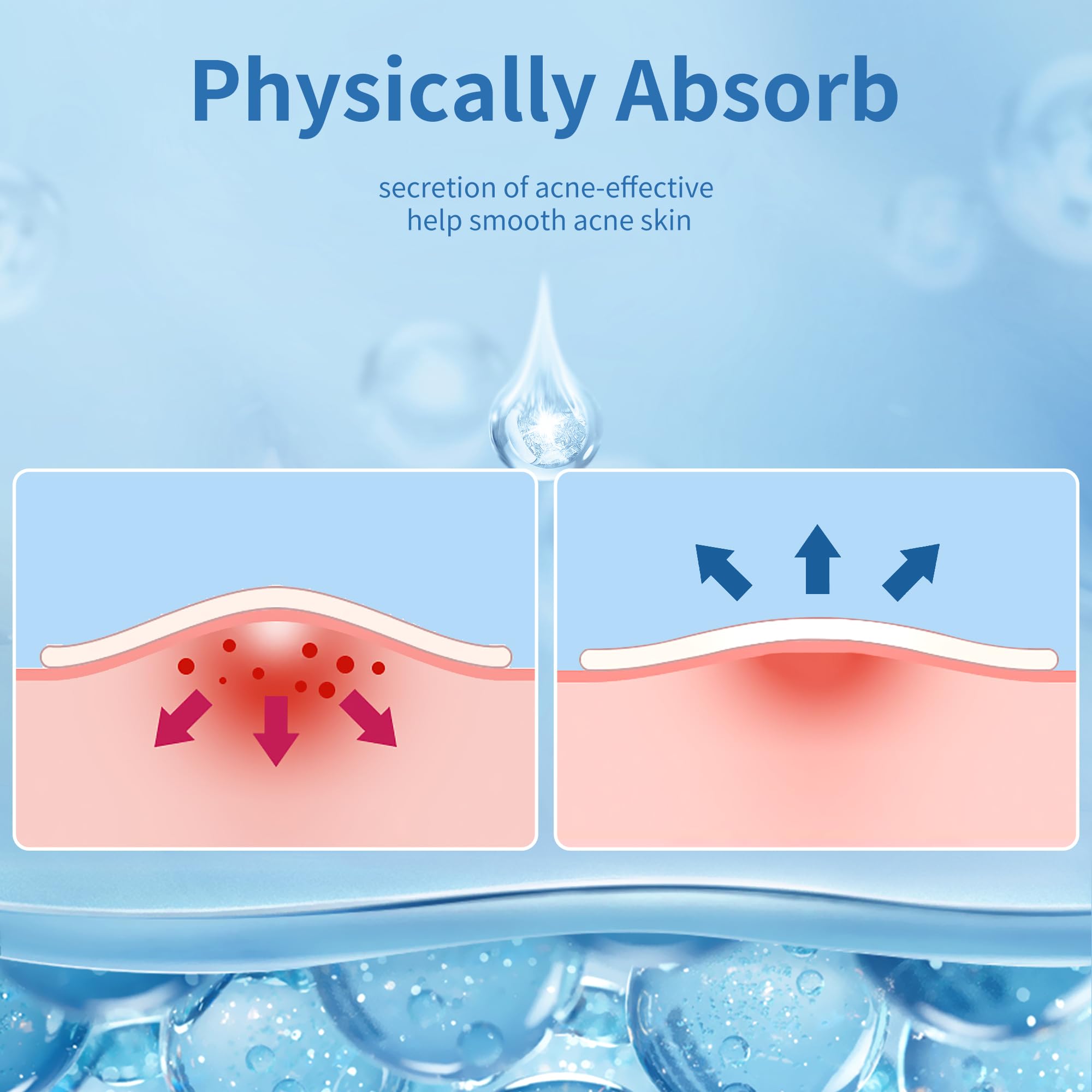 Daolyo pansement hydrocolloïde visage carré 60x60 mm, zone plus large traitée
