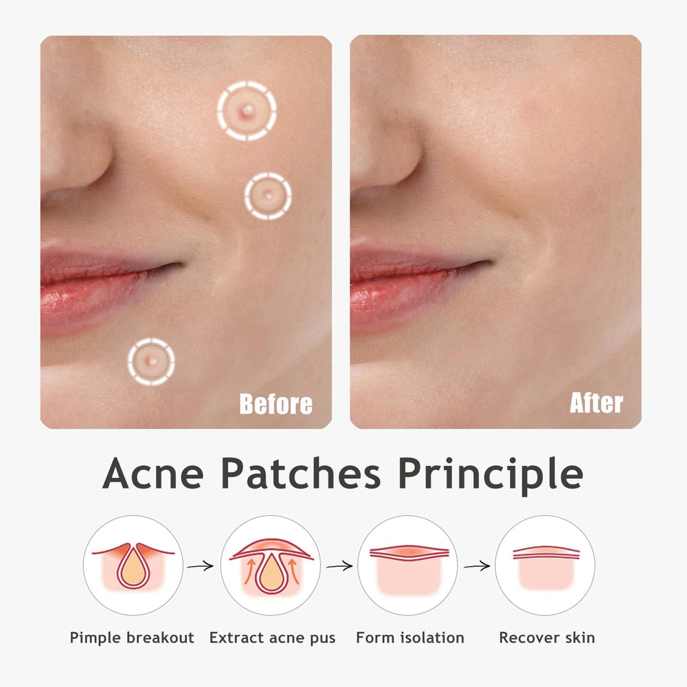 Pansement Dazzlook absorbe l’excès de fluide et protège la zone traitée.