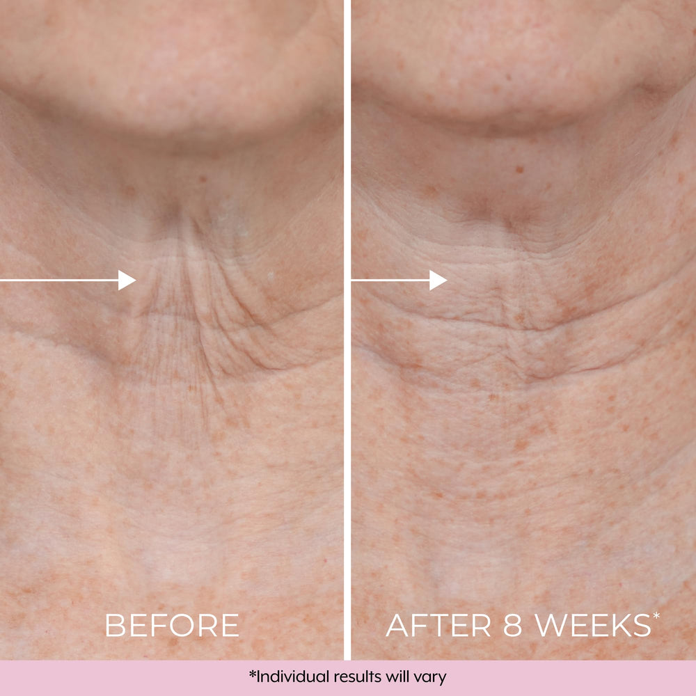 DEKLIDERM Ingrédients Retinol Bakuchiol: duo pour le cou et le décolleté.