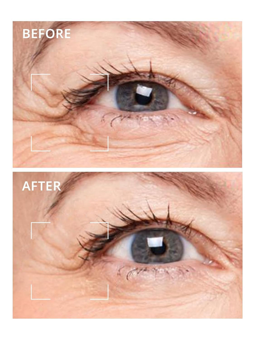 Usage nocturne Deepcare: patch yeux pour déshydratation et fatigue