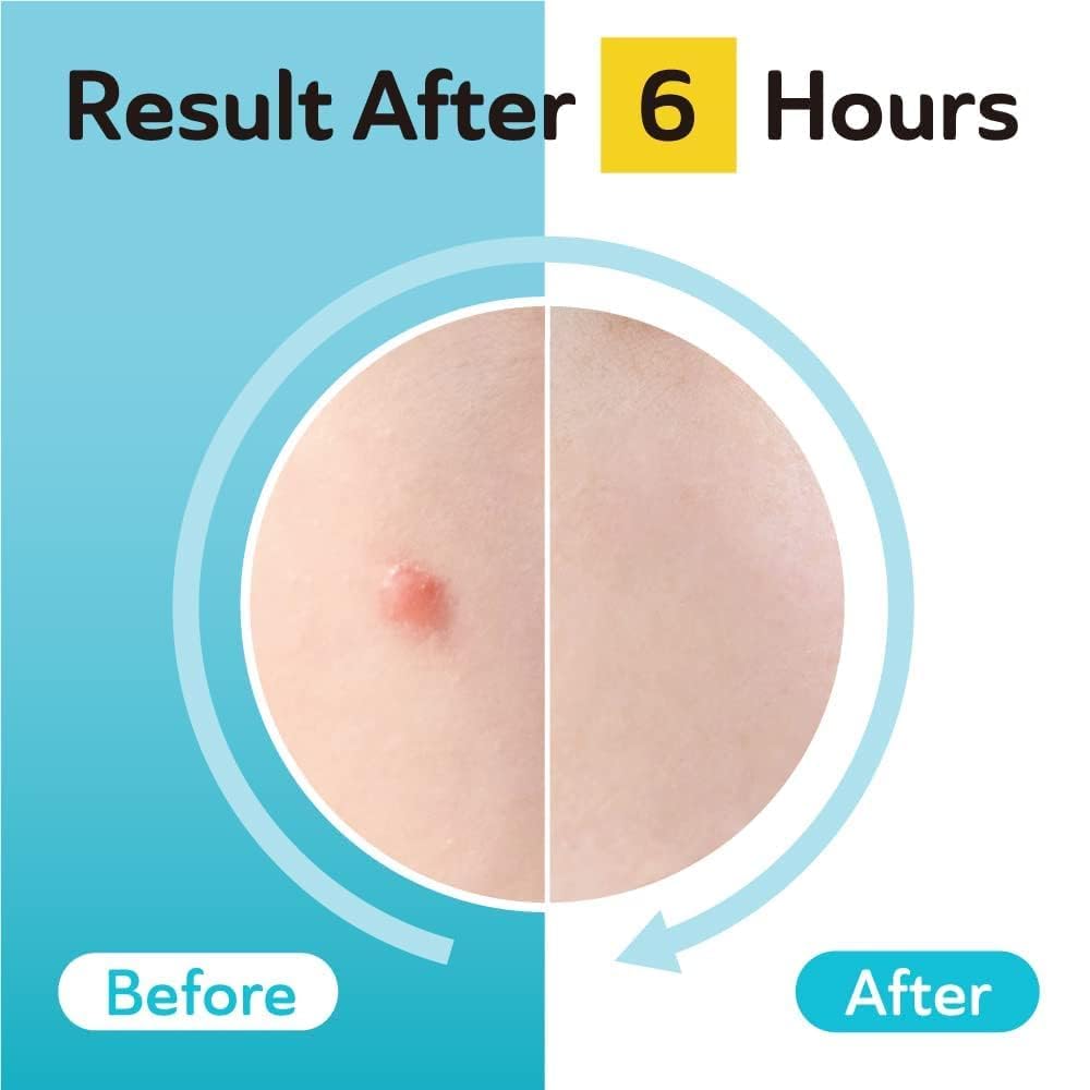 DERMA ANGEL emballage 132 pièces: pack pratique pour une routine post-acné.