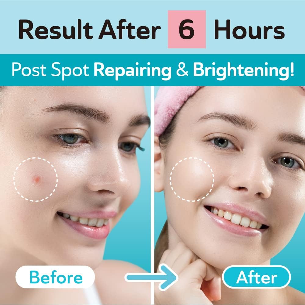 Pansements en deux tailles DERMA ANGEL jour et nuit pour une couverture adaptée.