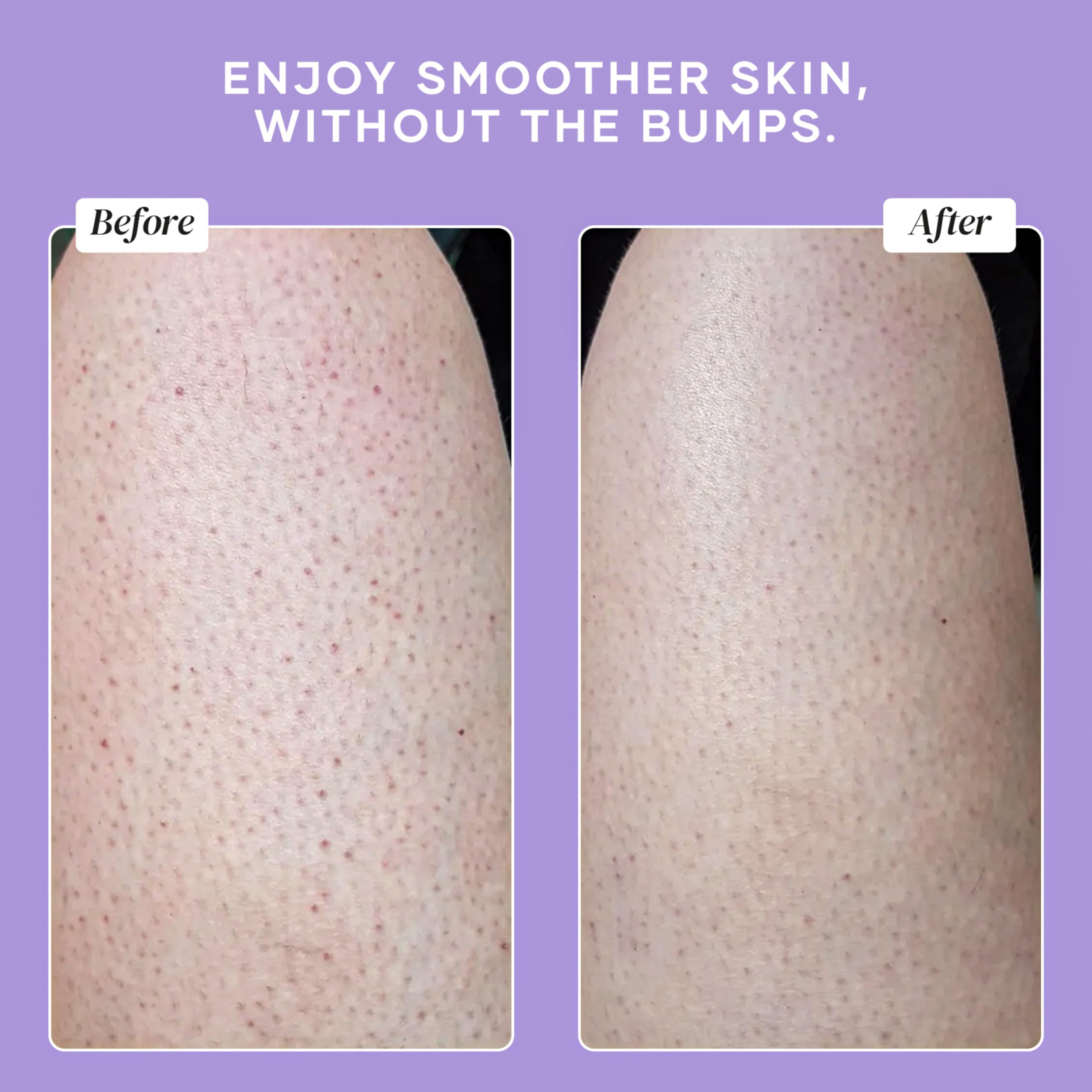 DERMAdoctor KP Bump Eraser, pores nets après gommage régulier