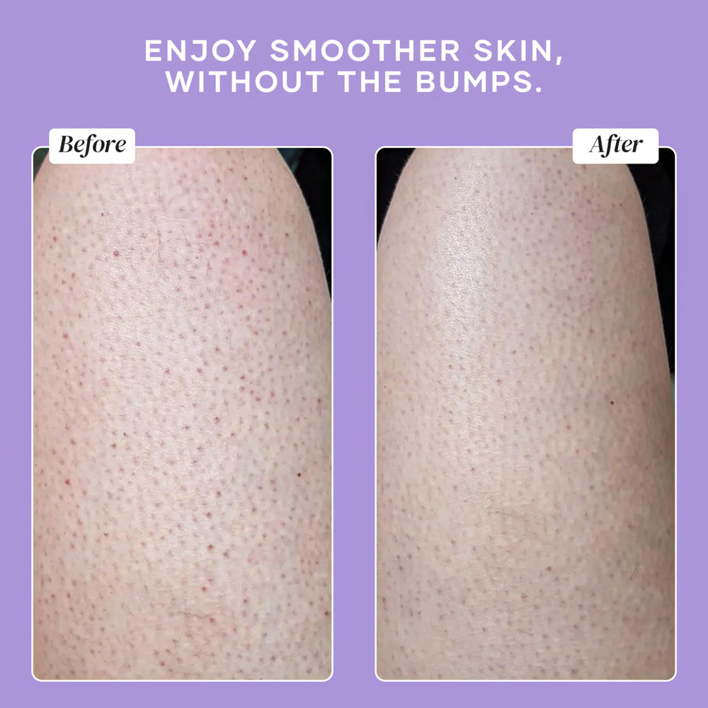 DERMAdoctor KP Bump Eraser flacon 237 ml sur le plan de bain