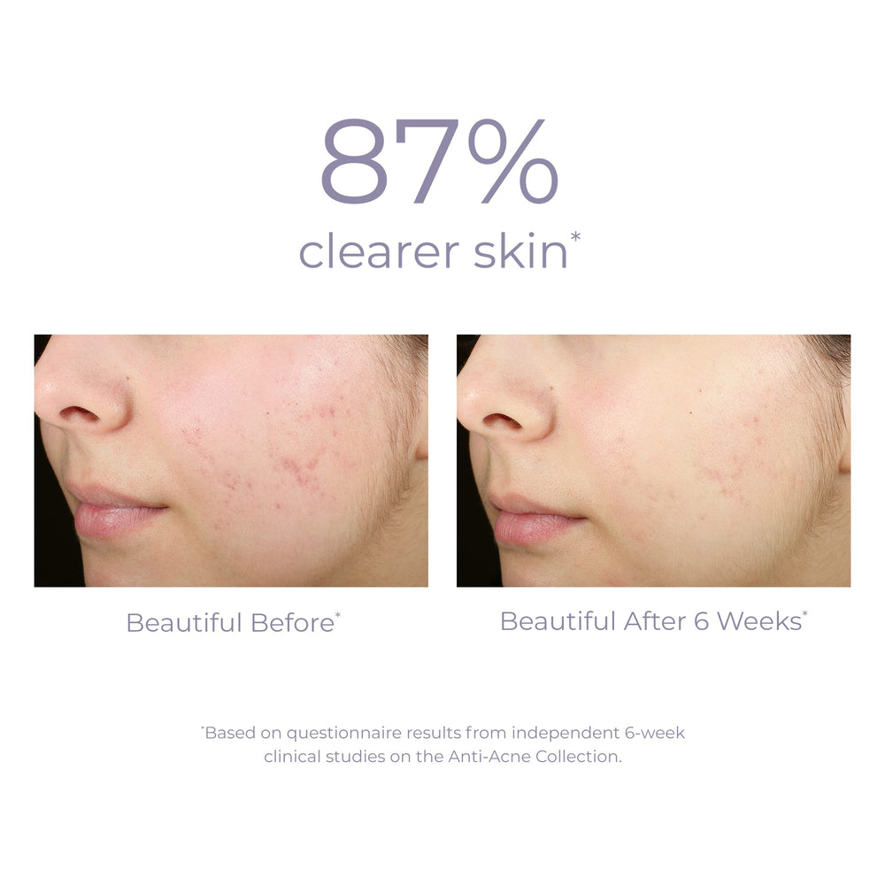 Derma E ingrédients naturels, acide salicylique et huiles essentielles aidant les pores.