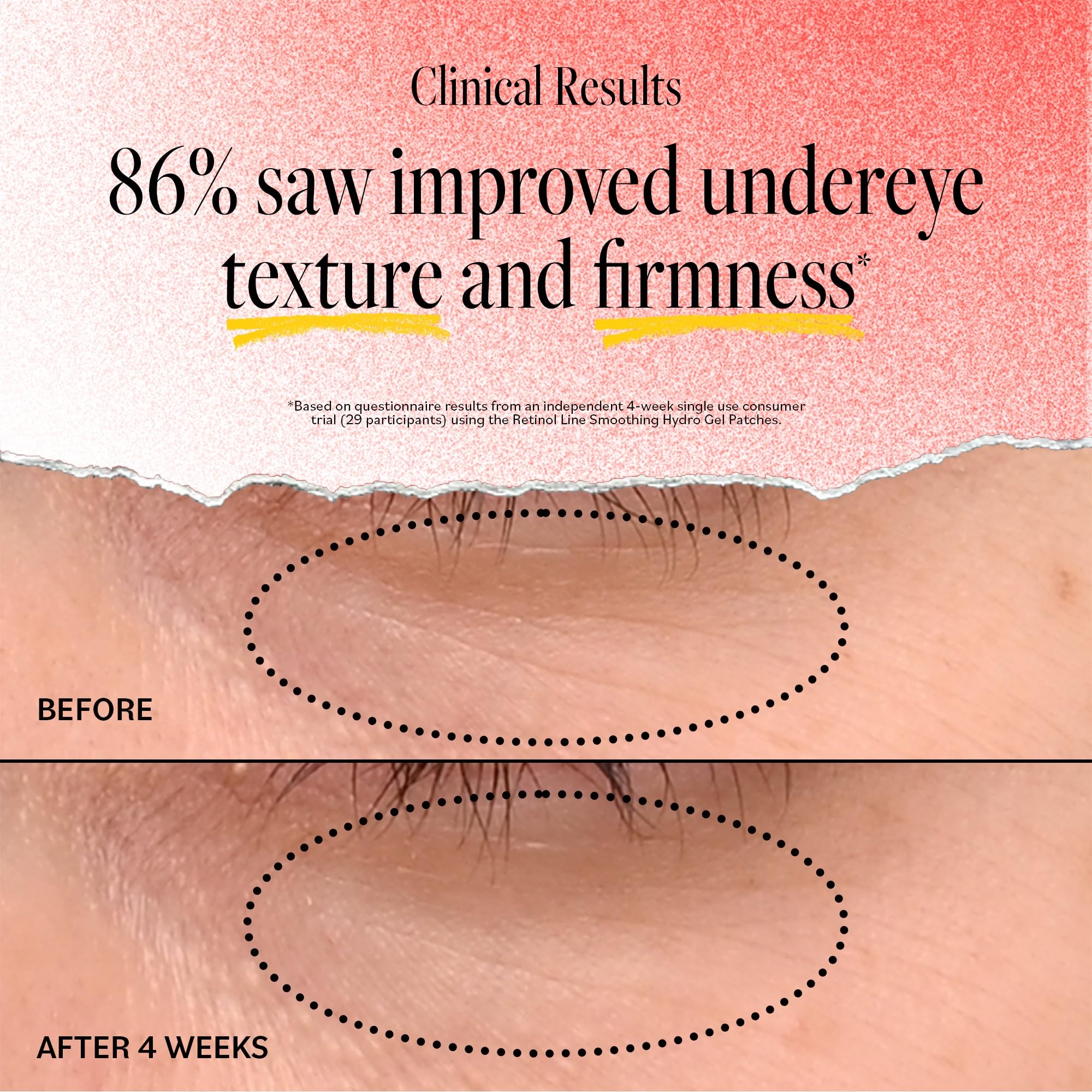 Patch yeux DERMA E lutte contre les cernes et signes de fatigue.