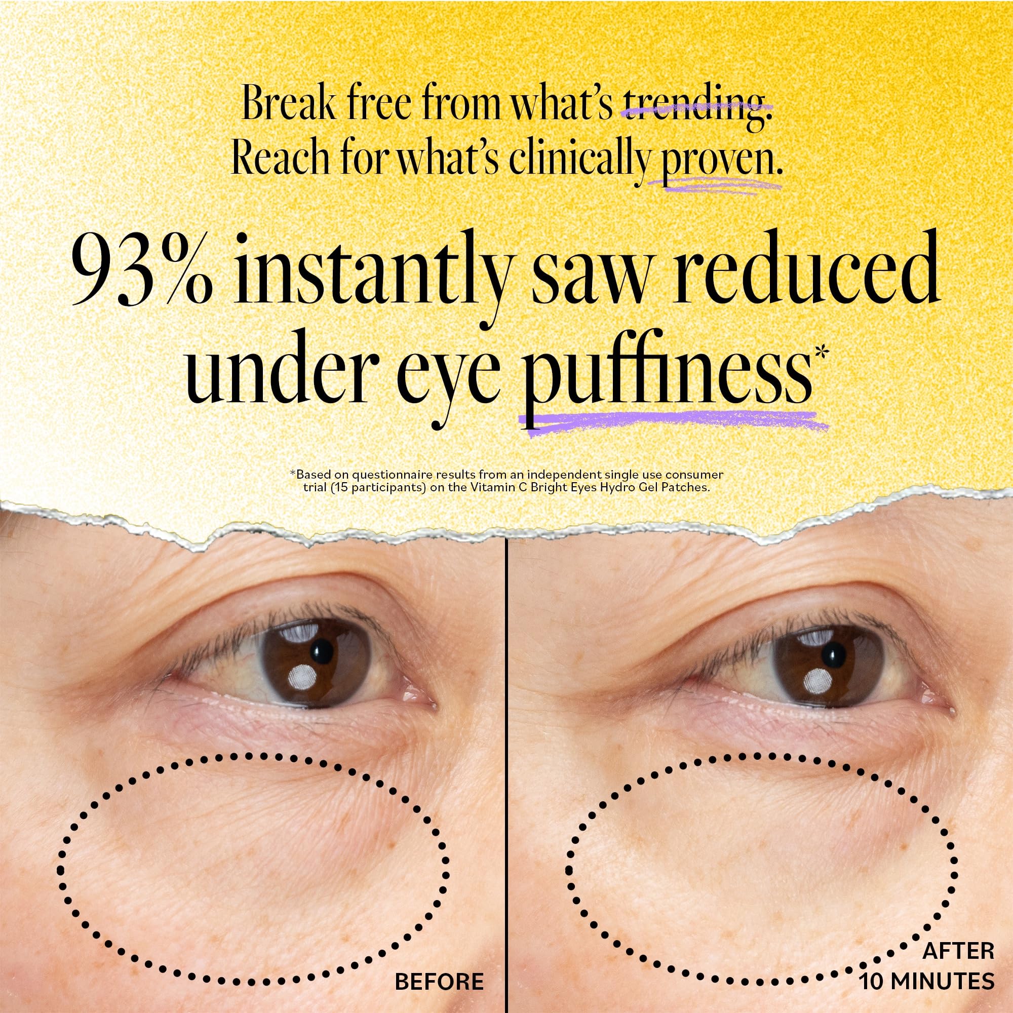 Patch hydrogel Derma E Yeux caféine pour décongestion matinale