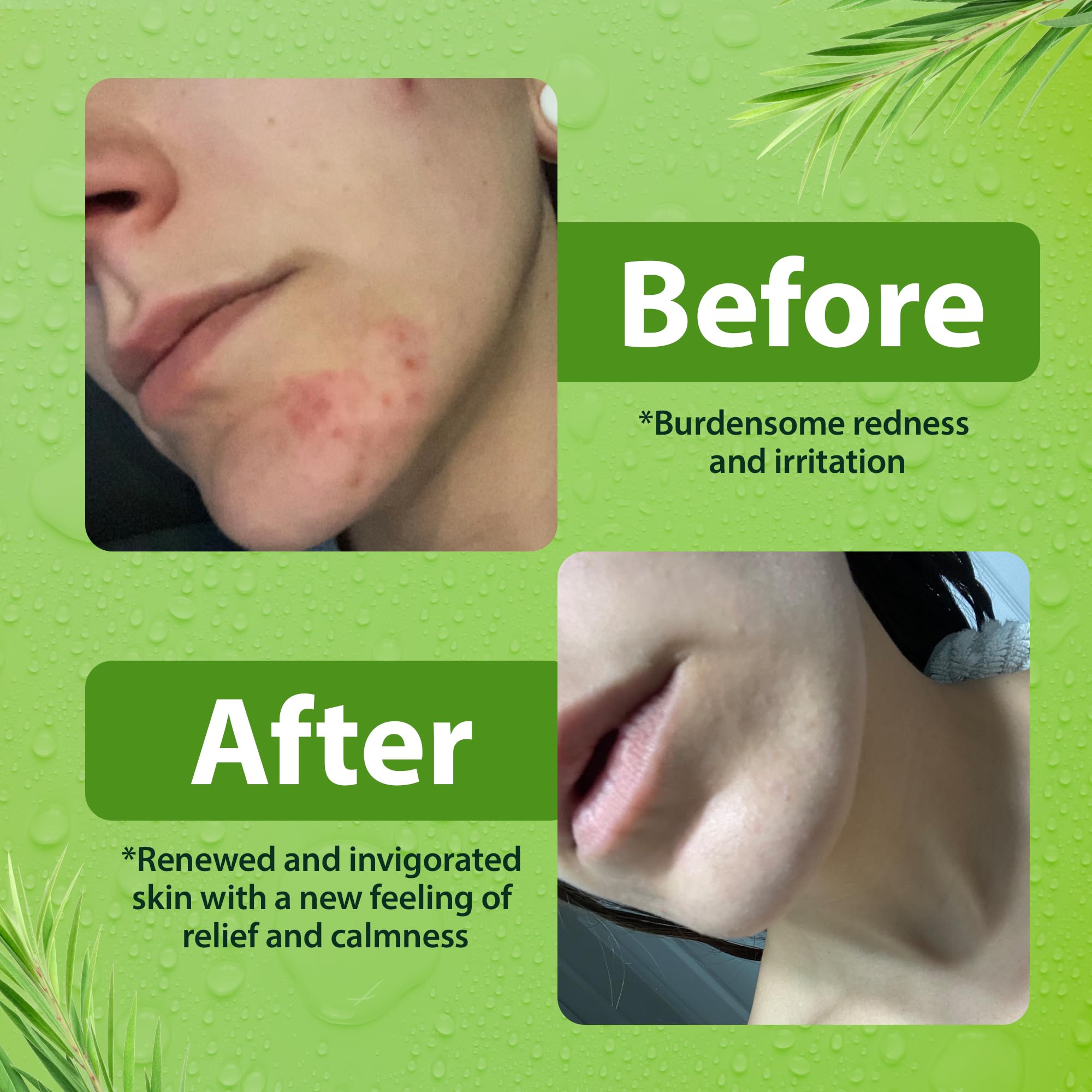 Derma-Nu USA-made cruelty-free soap suitable for all skin types.