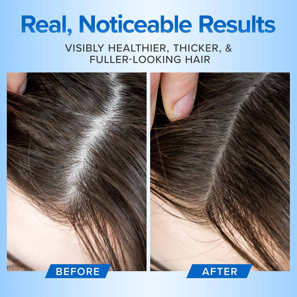 DermaChange Shampoo, densité et volume améliorés pour cheveux fins.