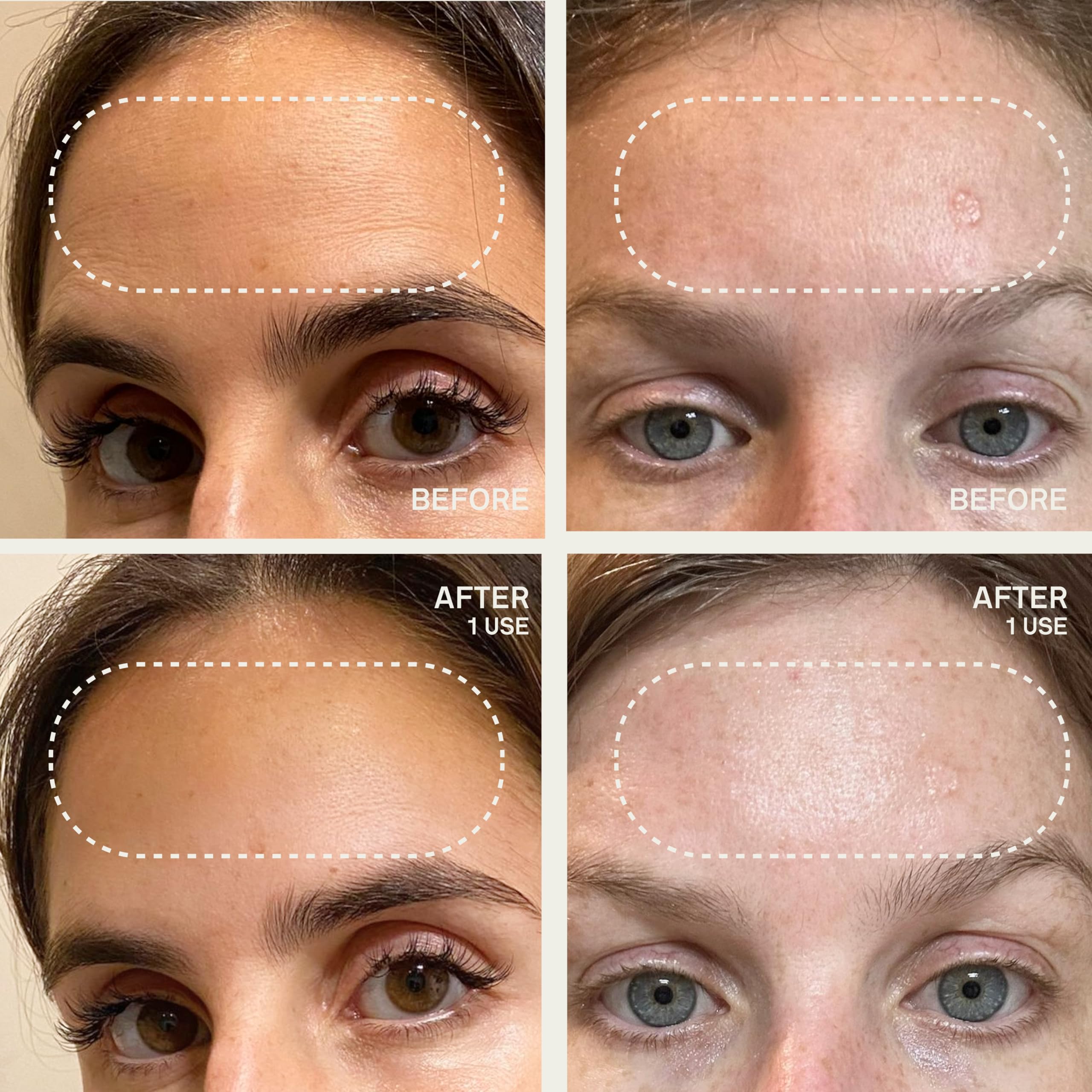 Dermaclara Patch Frontale agit comme primer doux avant les soins.