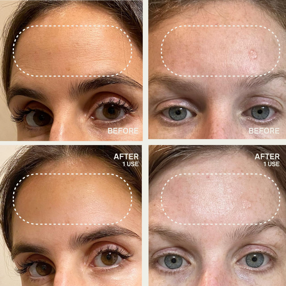 Dermaclara Patch Frontale agit comme primer doux avant les soins.