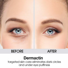 Dermactin anticernes et puffiness, application sous les yeux, réduction visible des poches et fatigue.