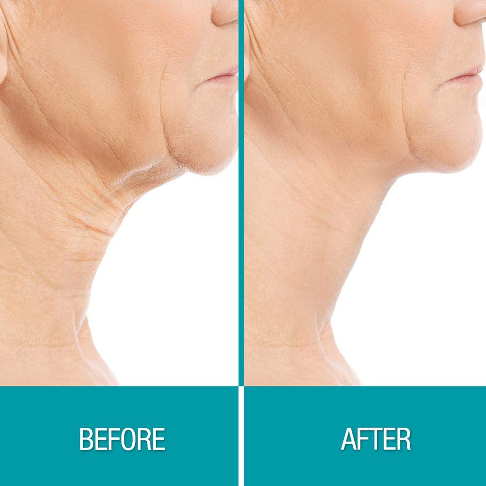 Texture satinée et peau douce avec Dermactin Crepe Be Gone