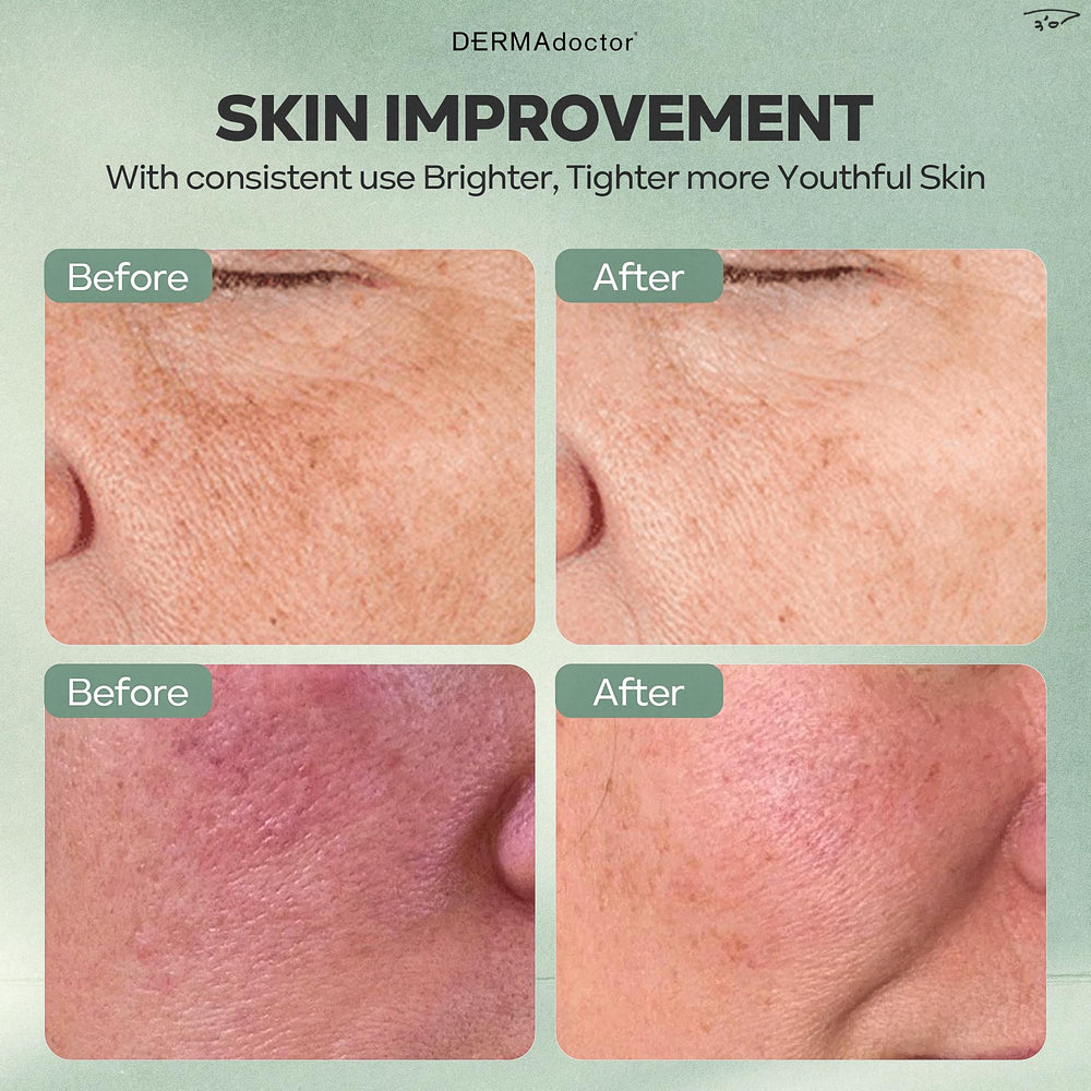 DERMADoctor Traitement taches brunes et dommages solaires, action douce.