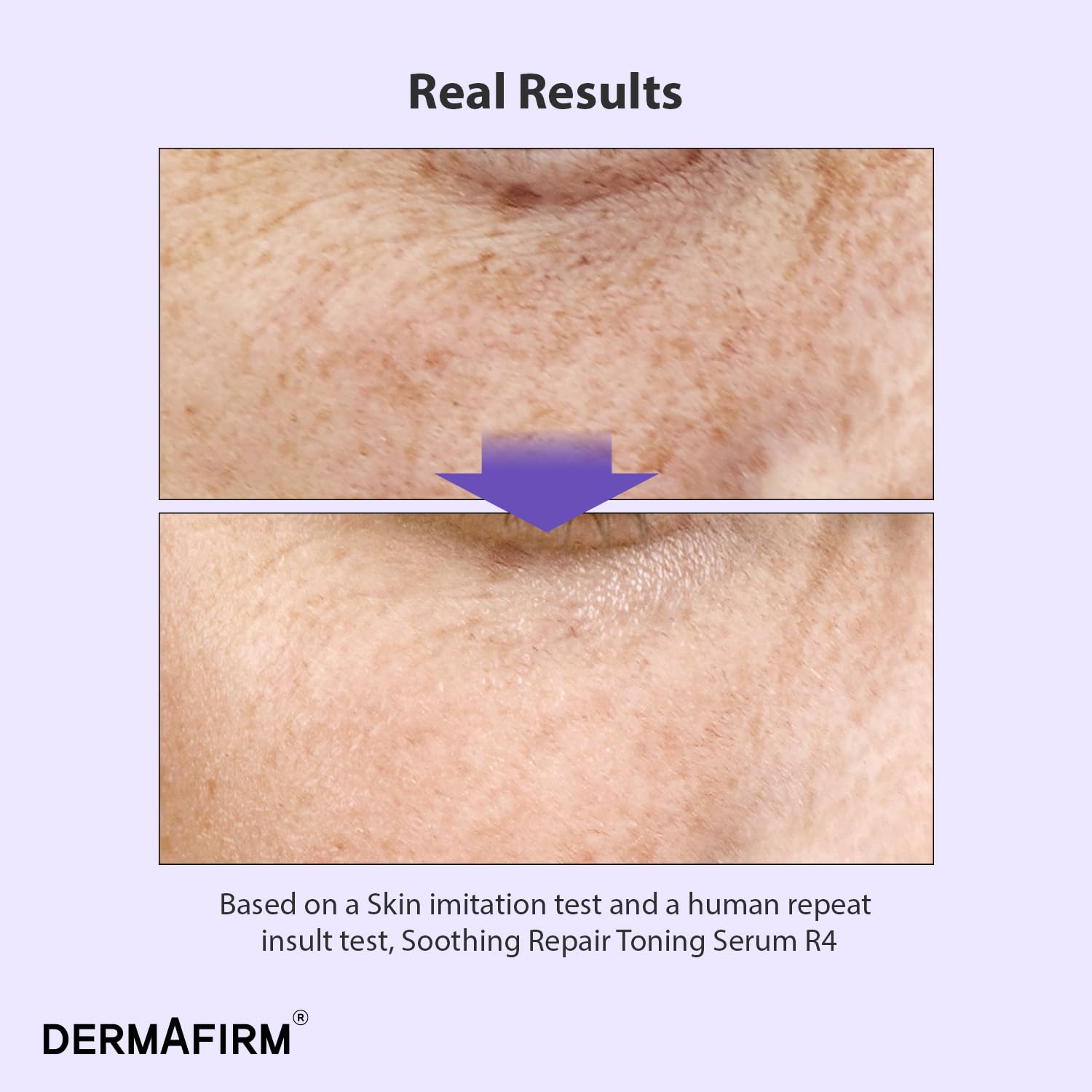 Dermafirm Eucalyptus R4 flacon: infusion apaisante pour peau sensible