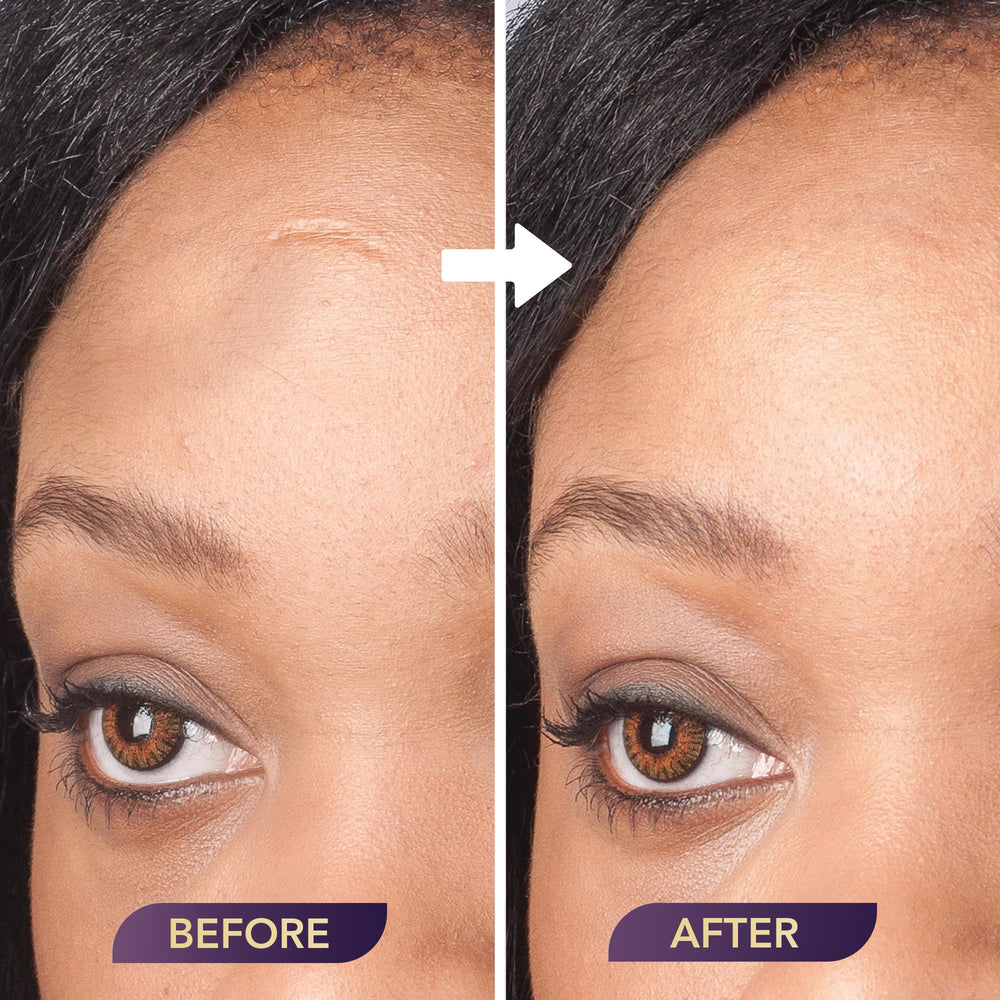 Flacon Dermaflage de 4 ml, suffisant pour de nombreuses applications.