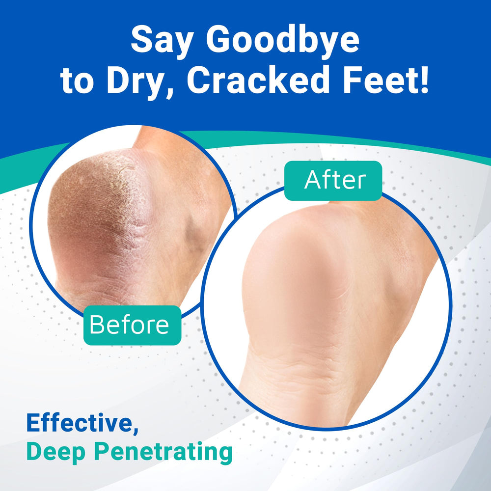 Application facile de la Crème Pieds Dermal Therapy pour une routine rapide.