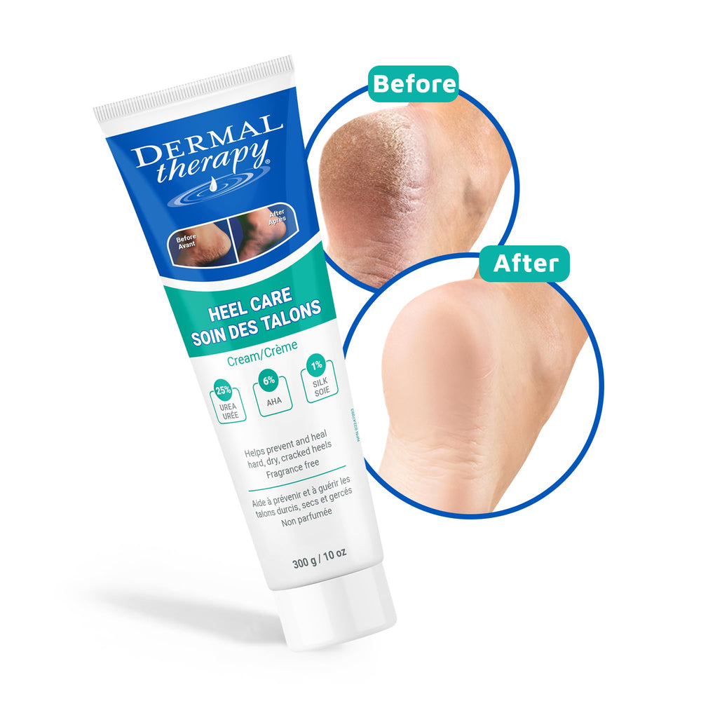 Hydratation quotidienne des pieds avec Dermal Therapy Crème Pieds.