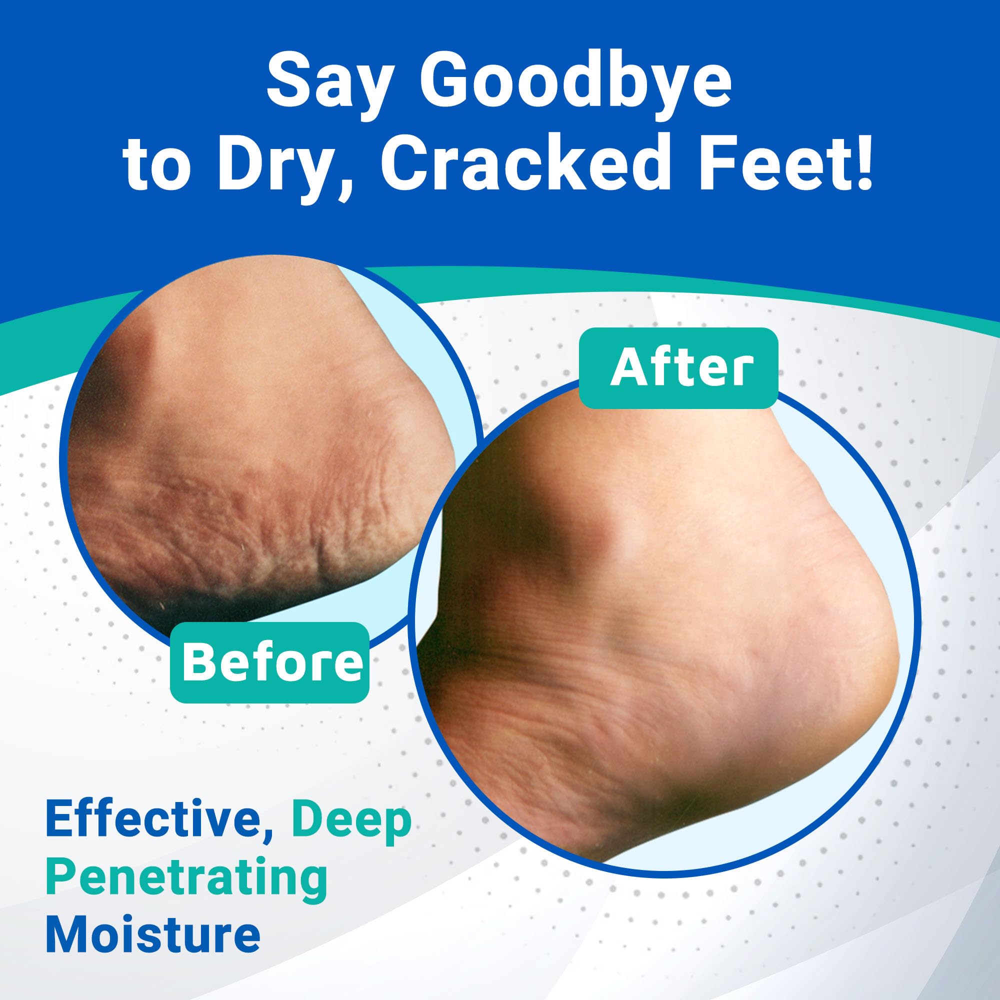 Dermal Therapy Crème: urée et AHA pour hydratation et exfoliation ciblées.