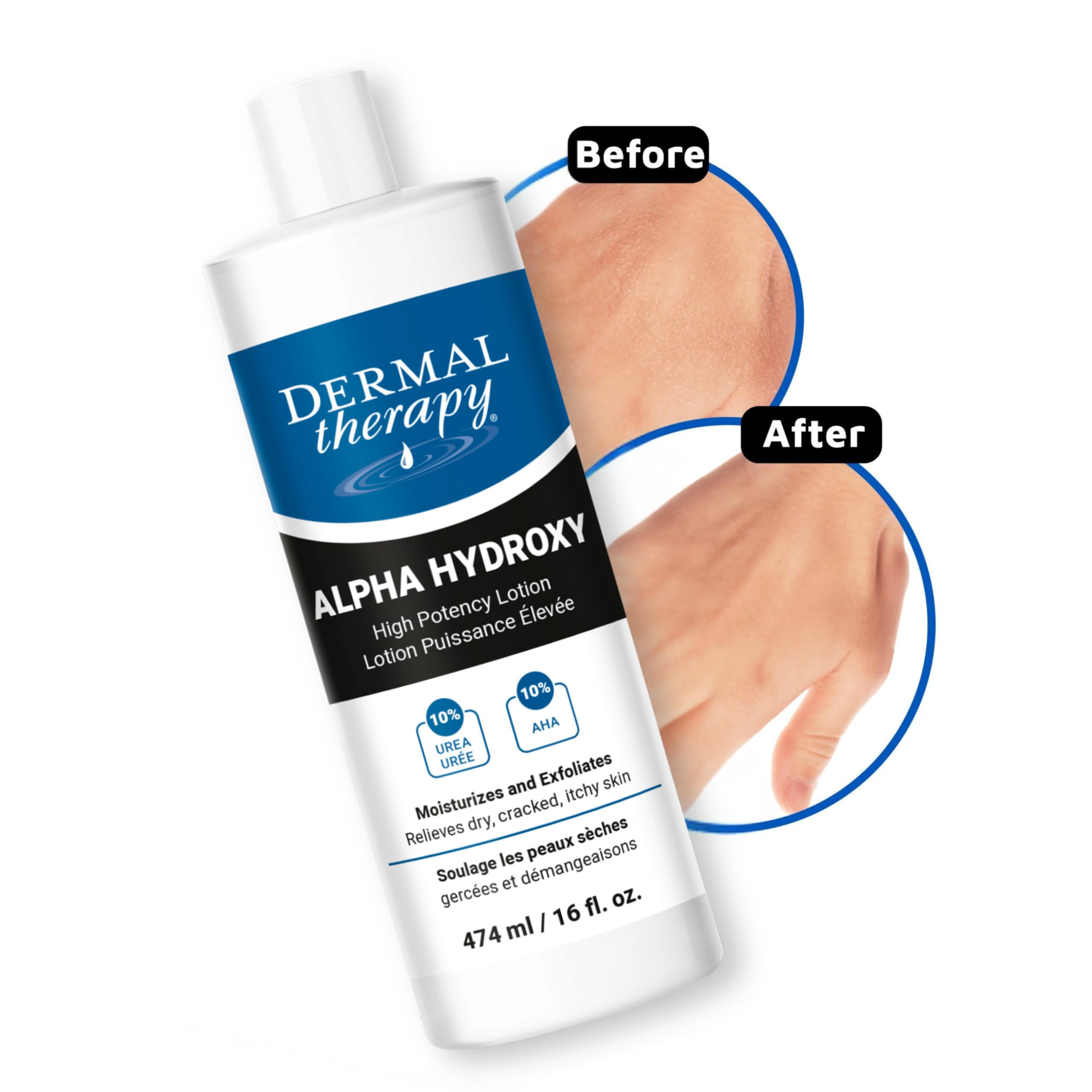 Dermal Therapy Alpha Hydroxy Lotion — hydratation efficace et douceur cutanée.