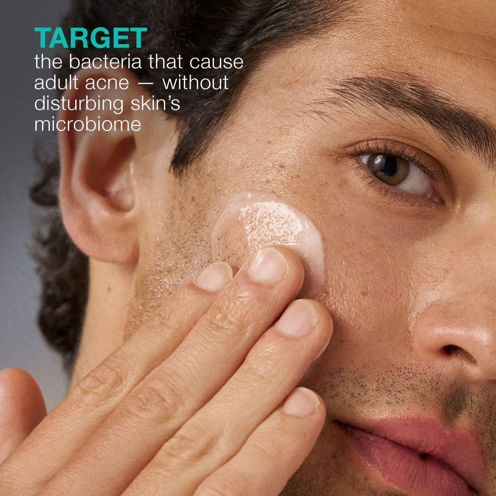 Dermalogica Acne Biotic – routine matinale simple et peau prête pour SPF