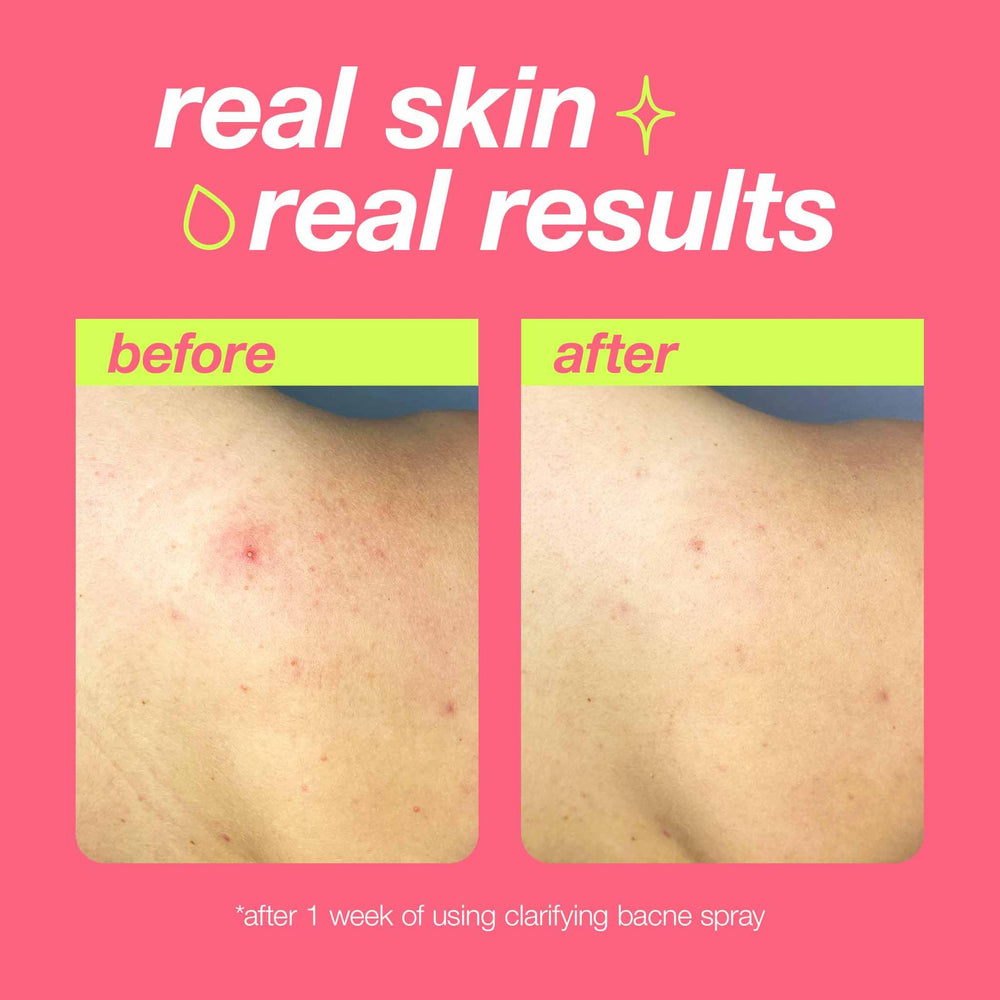 Dermalogica Clear Start huile argan: hydratation légère pour la peau.
