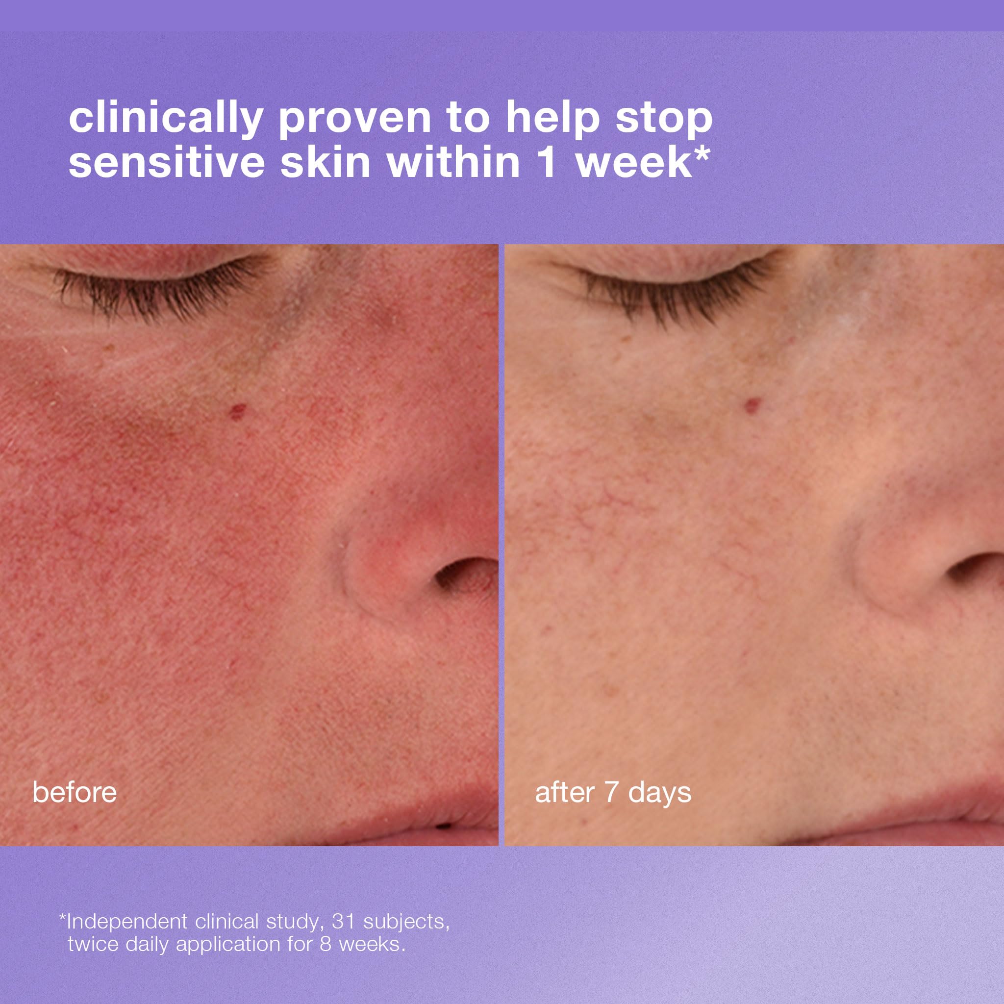 Dermalogica Crème Barrière Renforcée sur visage, protège peau sensible.