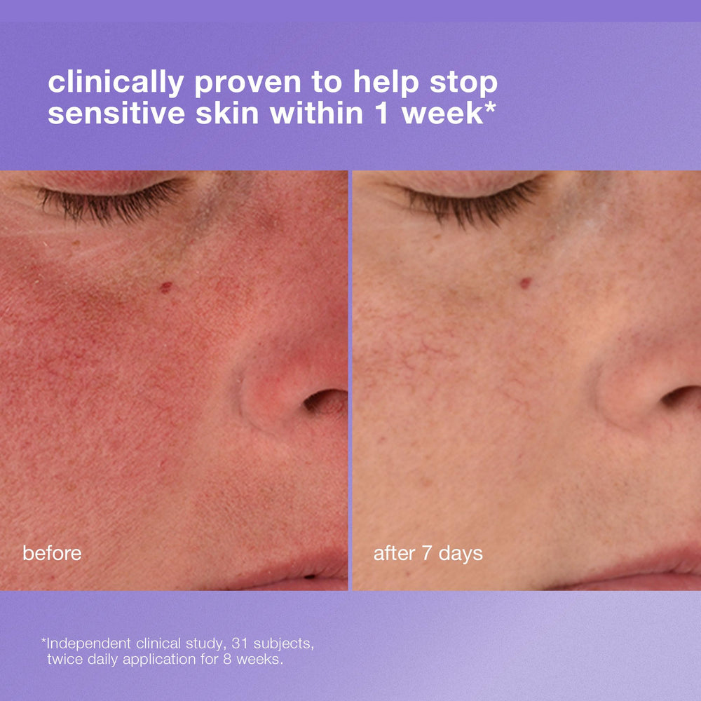Dermalogica Crème Barrière Renforcée sur visage, protège peau sensible.