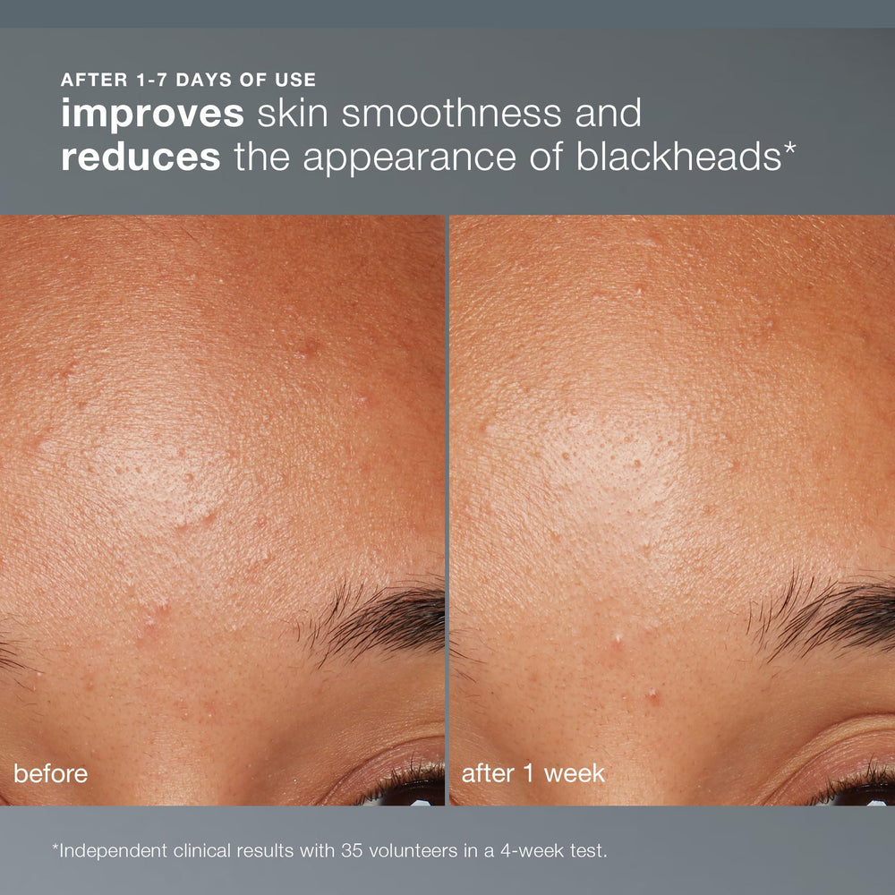 Dermalogica Daily Microfoliant mains mouillées démontrent l'application simple et rapide.