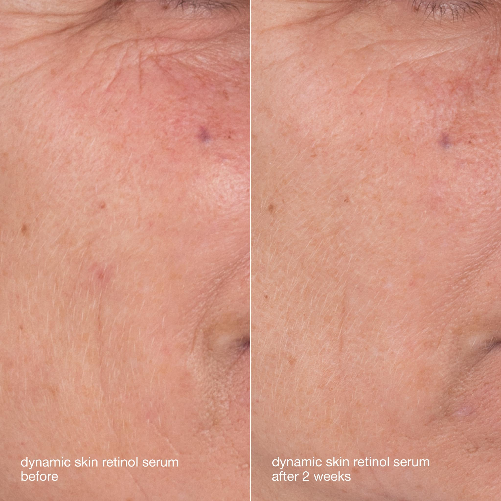 Dermalogica Étui-kit voyage montrant la praticité en déplacement