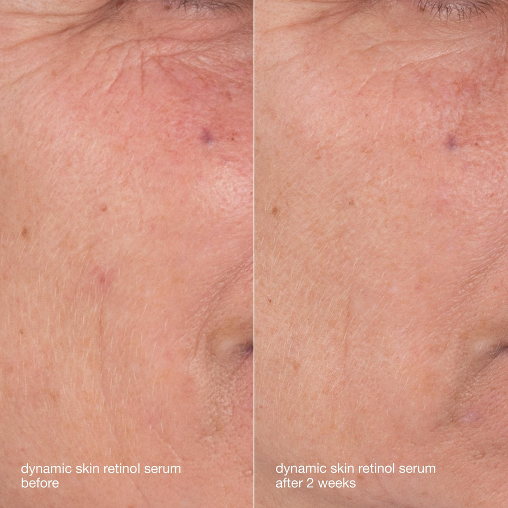 Dermalogica Étui-kit voyage montrant la praticité en déplacement