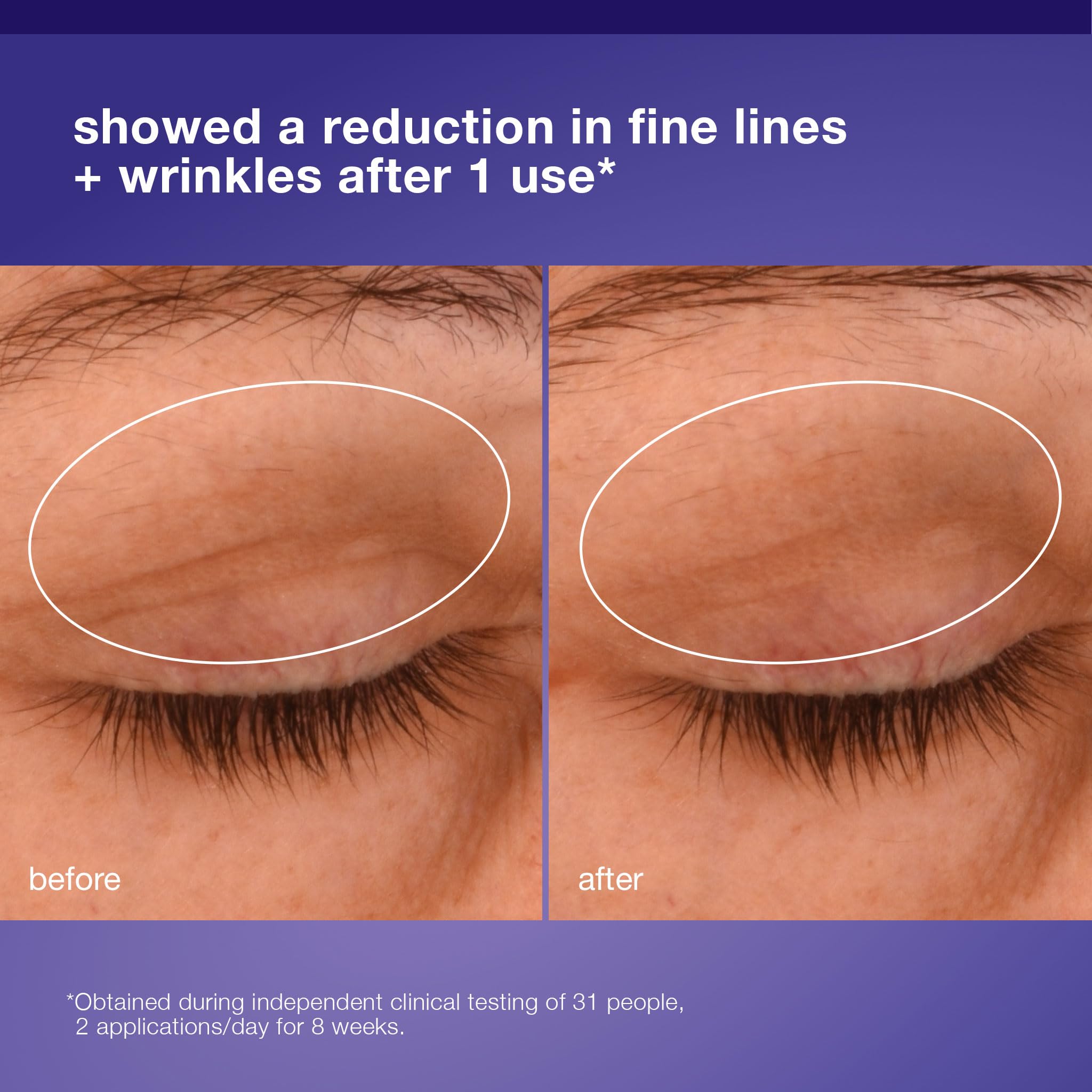Pro-Vitamine V5 dans Dermalogica Phyto Nature Lifting Eye Cream apaise et redensifie.