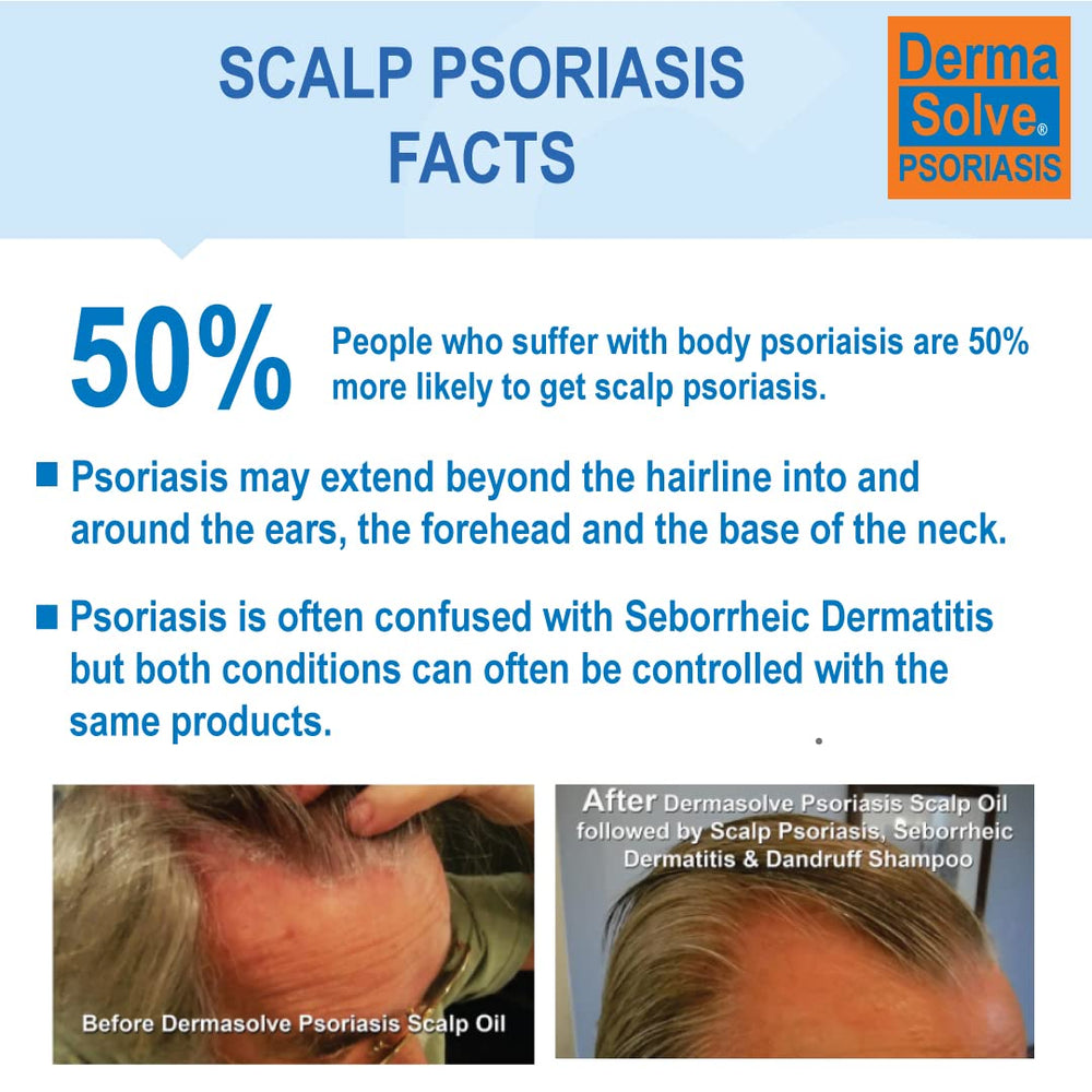 Dermasolve après-shampoing psoriasis, bouteille 2x8oz, démêlage facilité et hydratation.