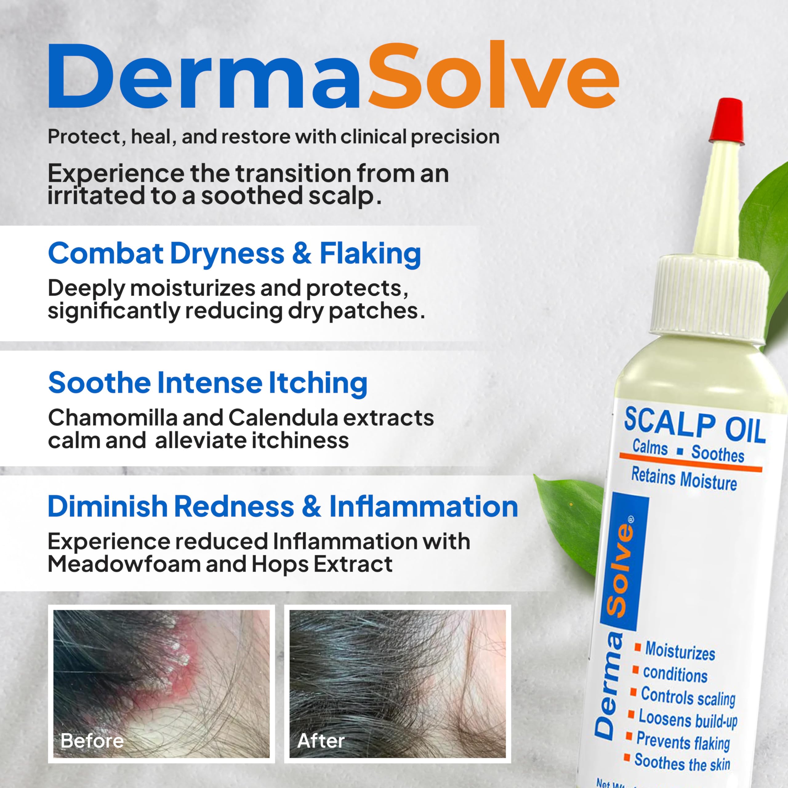 Dermasolve extrait camomille flacon, contact direct avec le cuir chevelu pour le confort.