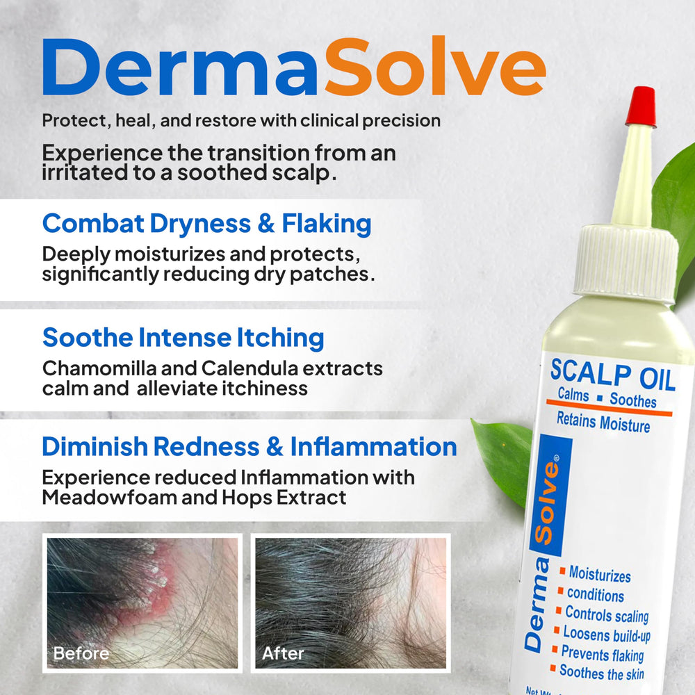 Dermasolve extrait camomille flacon, contact direct avec le cuir chevelu pour le confort.