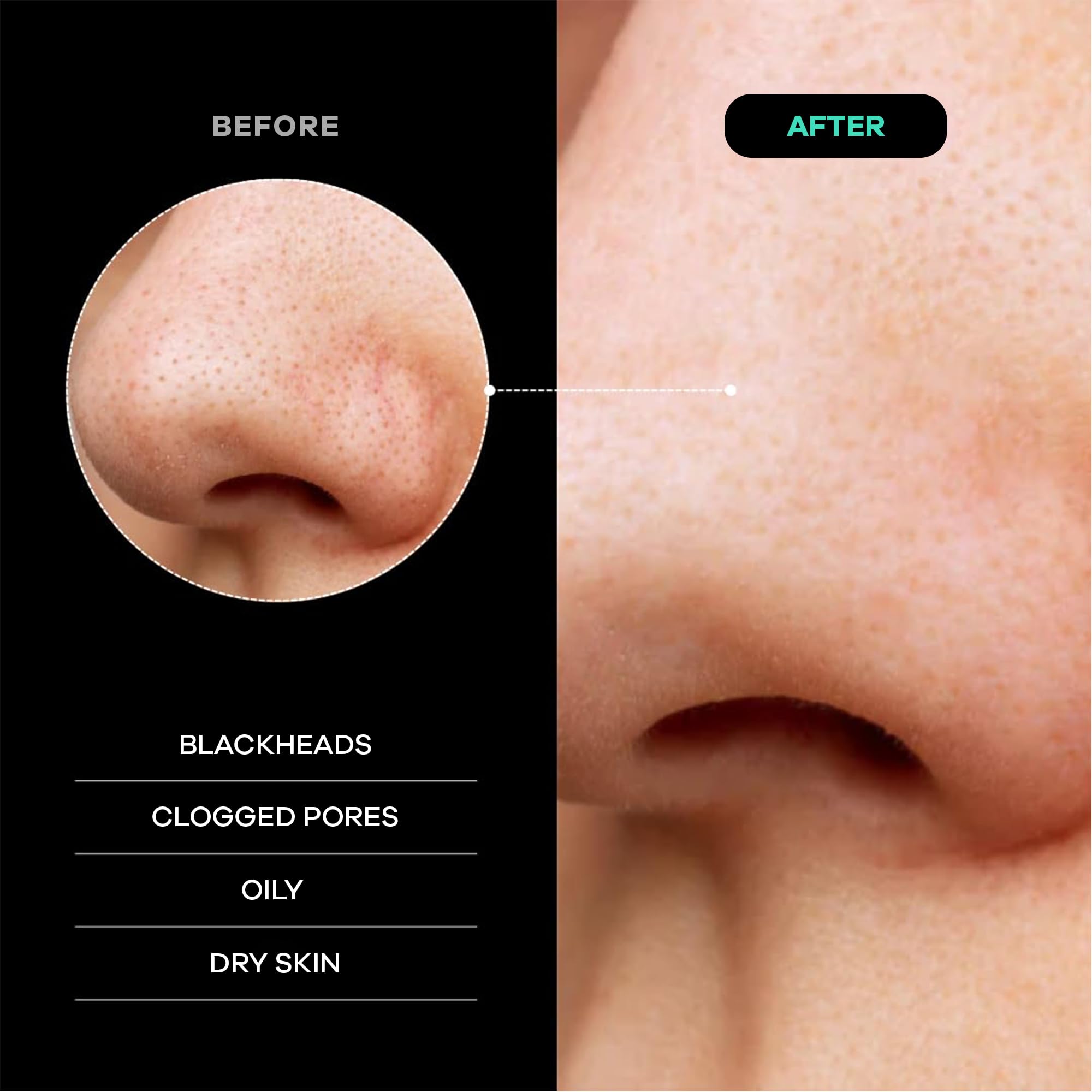 Dermasuri gant exfoliant corps peau lumineuse et douce après chaque séance.