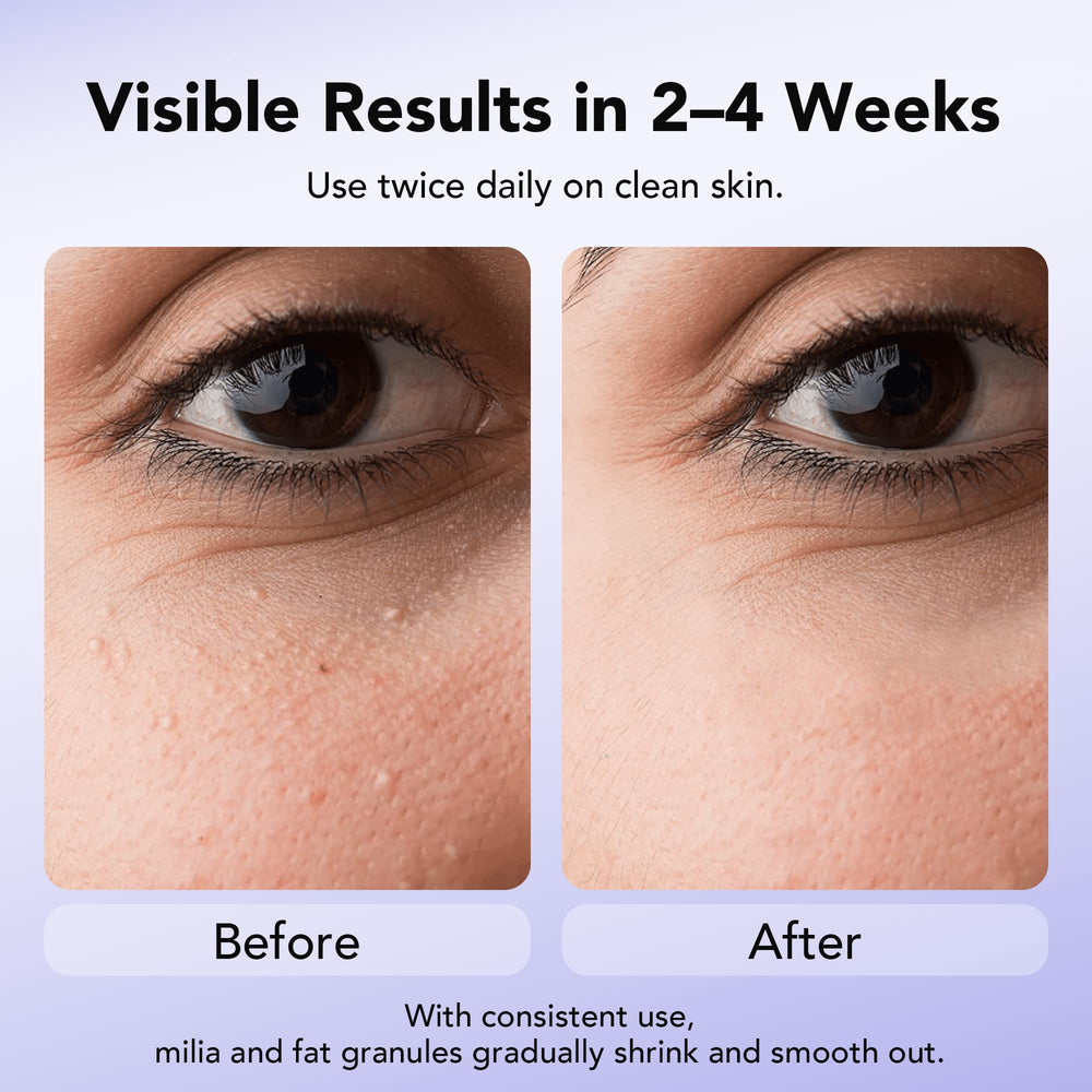 Composition douce avec acide salicylique pour exfolier en douceur