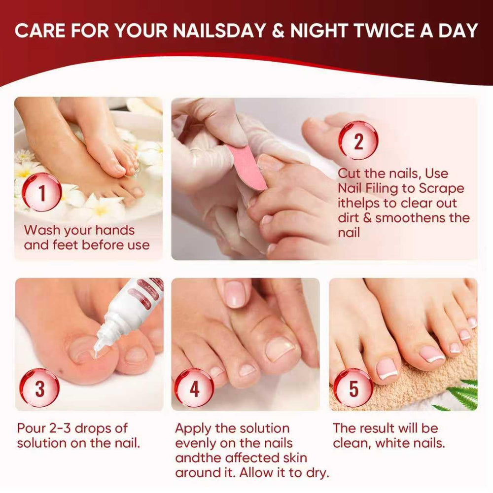 DERMFREE Traitement Ongles des Pieds – Gouttes faciles à déposer.