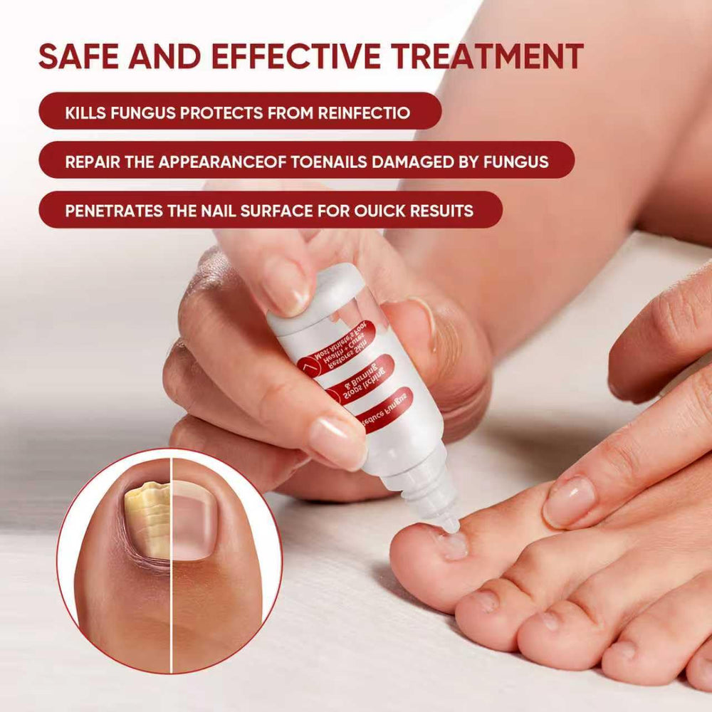 DERMFREE Traitement Ongles des Pieds – Usage quotidien pratique.