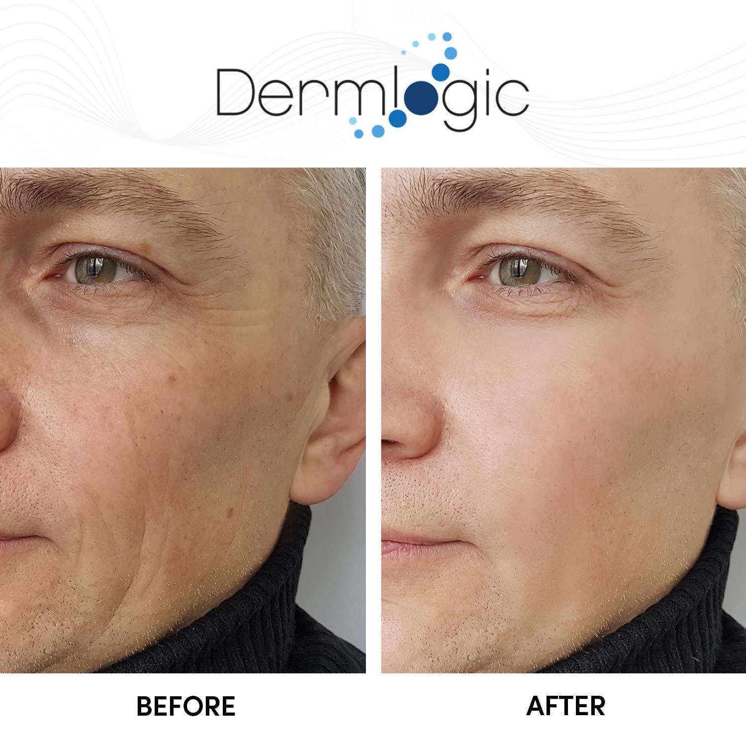Pompe Dermlogic Glycolique 15% – distribution précise du produit