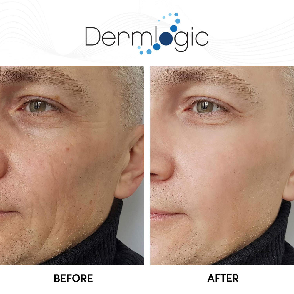 Pompe Dermlogic Glycolique 15% – distribution précise du produit